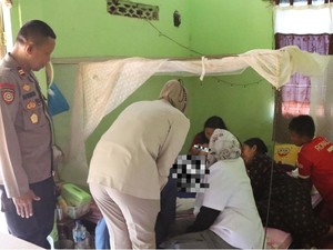 Balita Luka Parah Kena Api Saat Bakar Sampah, Polres Jepara Kirim Bantuan