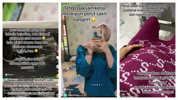 Viral Wanita Curhat Perut Membesar Bak Hamil, Ternyata Kena Kista Ginjal