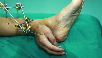 Melihat pose anjing melompat ini cukup Foto: Reddit via Boredpanda