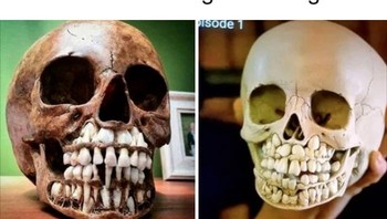 Rangka balita yang menunjukan susunan gigi yang diawai dengan pertumbuhan gigi susu kemudian diikuti oertumbuhan gigi permanen. Foto: Reddit via Boredpanda