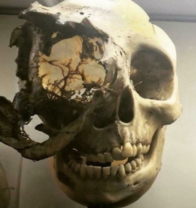 Foto aneh bikin merinding