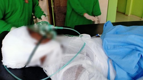 Lansia asal  Klungkung, I Nyoman J, saat mendapatkan perawatan di RSUD Klungkung, Kamis (2/11/2023). Lansia itu nekat mencoba mengakhiri hidupnya dengan membakar dirinya.