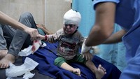 Jerit tangis anak memecah suasana rumah sakit yang merawat korban luka akibat serangan Israel. AP Photo/Hatem Moussa.  