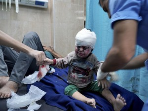 Nasib Bayi 16 Bulan di Gaza Korban Serangan Israel: Terancam Lumpuh Seumur Hidup