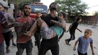 Korban luka terutama anak-anak terus berjatuhan di Jalur Gaza. AP Photo/Abed Khaled.  