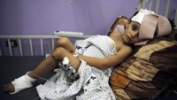 Kenzi al Madhoun (4), menjalani perawatan di rumah sakit di Jalur Gaza. Anak itu menderita luka di bagian kepada dan kaki. AP Photo/Abdel Kareem Hana.  