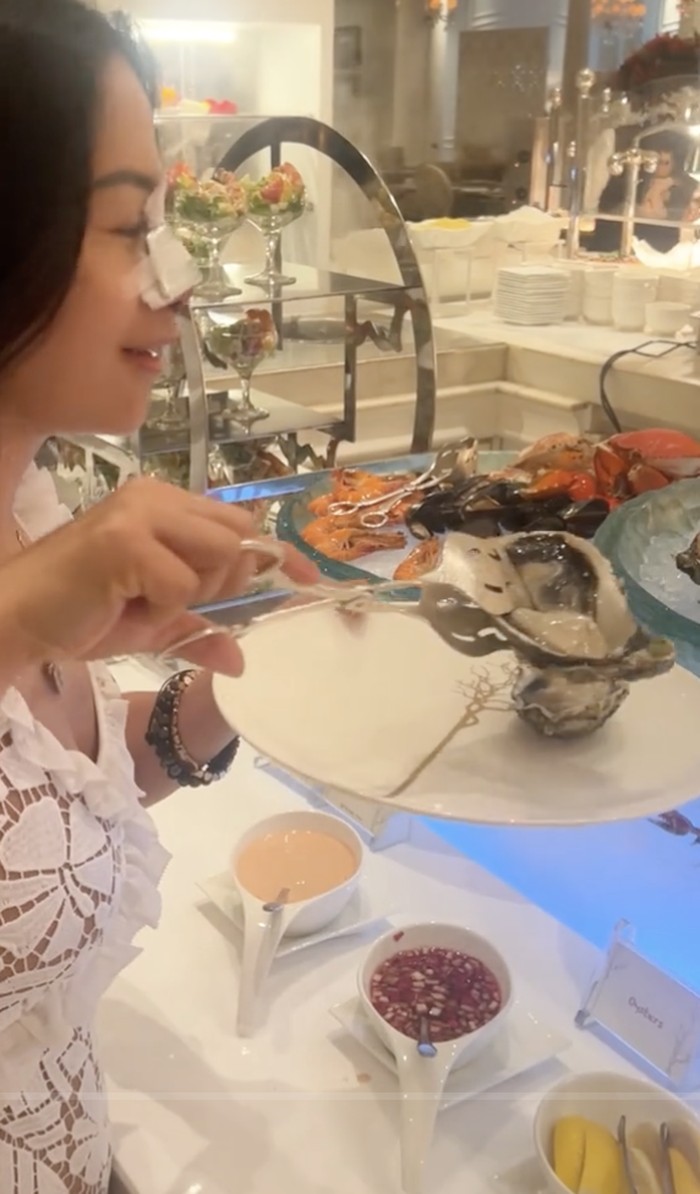 Farida Nurhan 'Omay' Brunch di Hotel Mewah dengan Kondisi Hidung Diperban