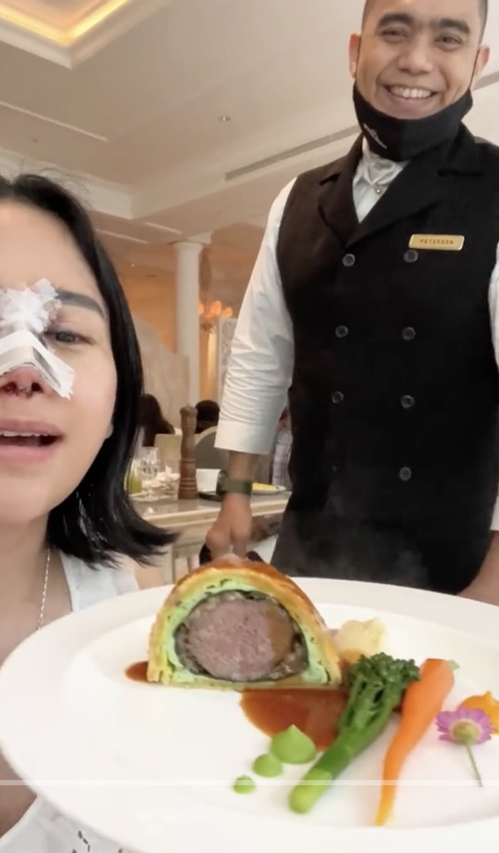 Farida Nurhan 'Omay' Brunch di Hotel Mewah dengan Kondisi Hidung Diperban