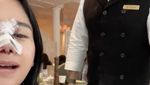 Farida Nurhan Omay Brunch di Hotel Mewah dengan Kondisi Hidung Diperban