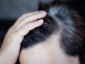 Viral Tren Suntik Obat Uban di China, Rambut Putih Diklaim Bisa Kembali Hitam