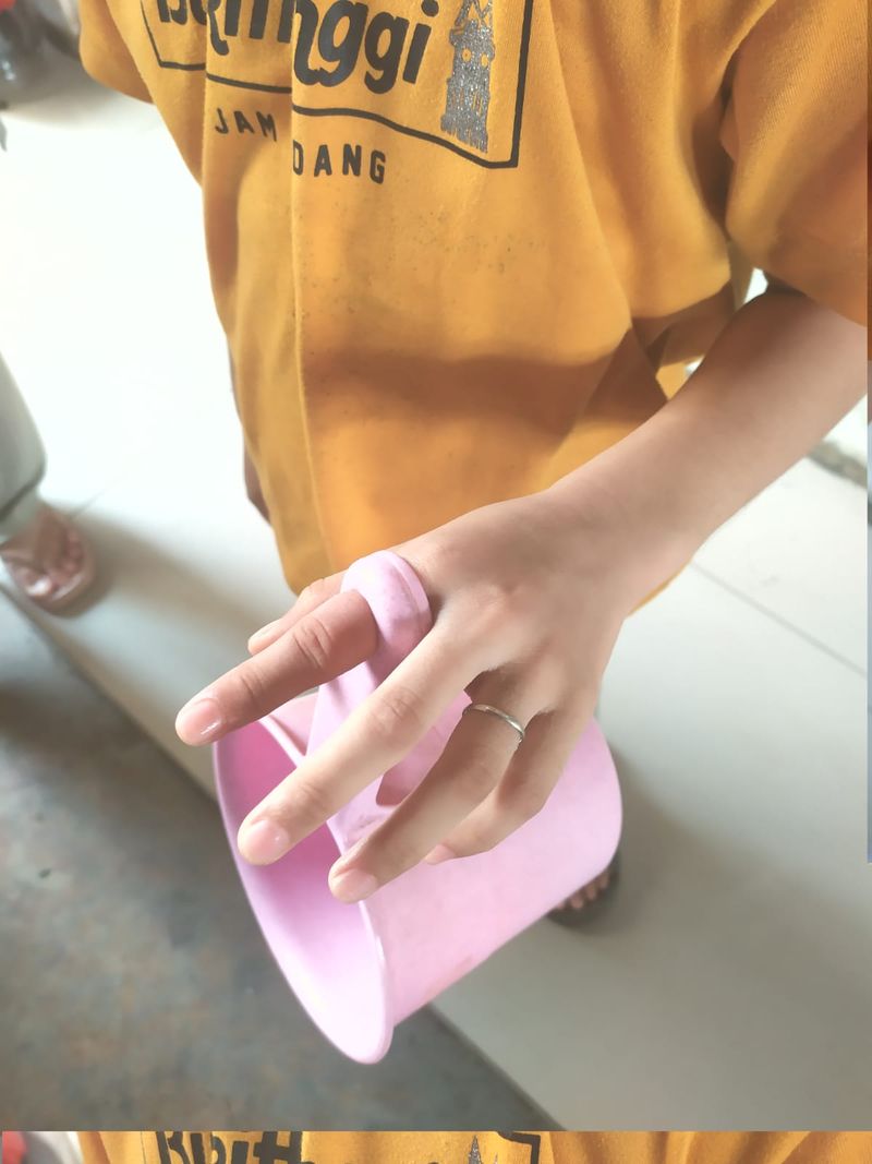 Jari gadis kecil menyangkut di lubang gayung, Damkar Kabupaten Bogor menolong. (Dok Istimewa)