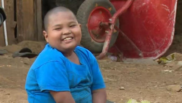 Keterbatasan fisik tidak menyurutkan keceriaan Rizky, anak disabilitas yang viral saat dirinya disuapi teman sekolahnya. Yuk, kita bantu Rizky!