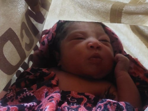 Bayi perempuan saat dirawat di RS Bhayangkara Titus Uli Kupang, NTT. (Dok Polsek Kelapa Lima)