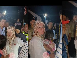Sederet Kasus Sindrom Manusia Serigala, Wajah Penuh Rambut gegara Penyakit Langka