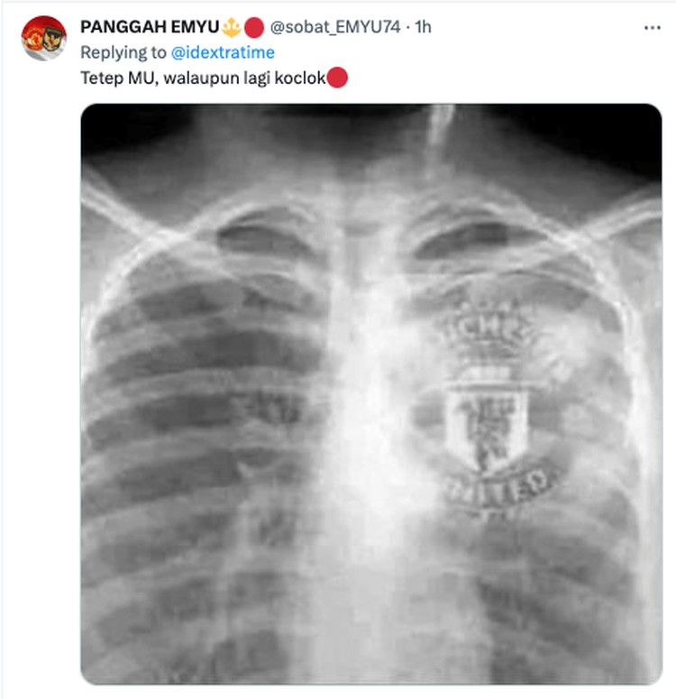 Meme MU Ronaldo