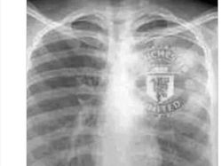 Meme Ronaldo Tidur Nyenyak Usai MU Dibantai Copenhagen