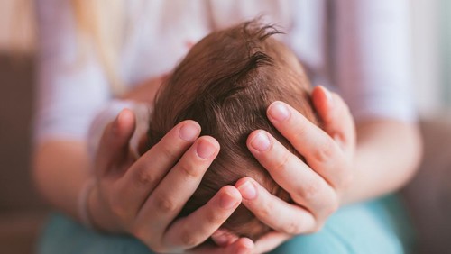 Ilustrasi Sindrom Manusia Serigala