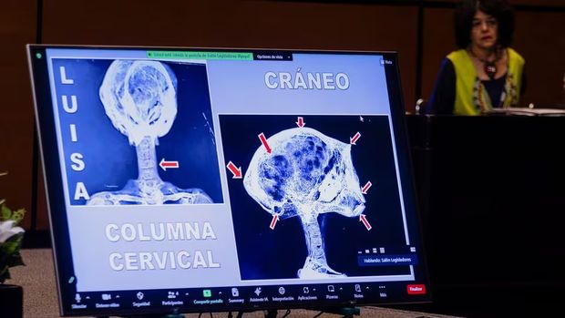 jasad alien jasad alien