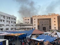 Cerita Dokter Gaza Amputasi Kaki Keponakan di Rumah Tanpa Bius