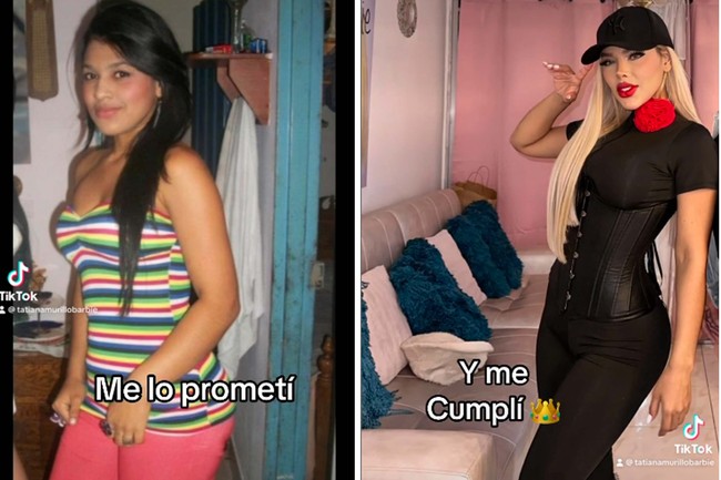 Meski menyakitkan, wanita 29 tahun tersebut merasa sukses. Aku percaya cerita menjadi aktor dan menjadi unik di Kolombia karena itu. Itu seperti balas dendam kepada orang-orang yang mem-bully-ku. Dari kecil aku bilang balas dendamku akan sukses dan aku sudah meraihnya, tutur Tatiana. Foto: Instagram Tatiana Murillo