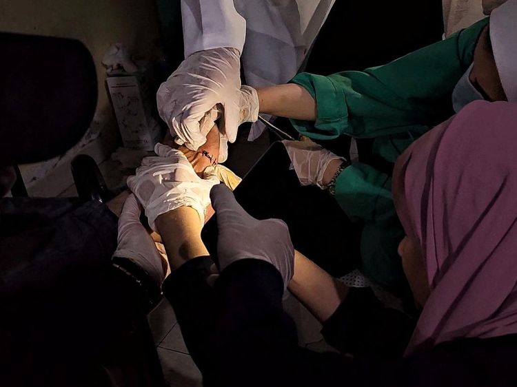 Listrik Padam, RS Indonesia di Gaza Lakukan Tindakan Medis dengan Senter