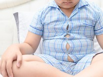 Susu Bikin Anak Obesitas? Begini Kata Profesor Tumbuh Kembang FKUI