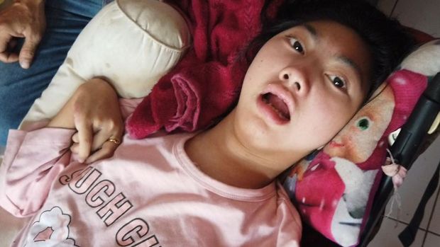 Mutia, penderita cerebral palsy di Sukabumi sekaligus penerima donasi berbuatbaik.id.