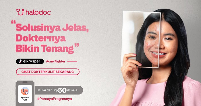 Bye Jerawat, Ini Jurus Perawatan Tepat buat Punya Kulit Sehat