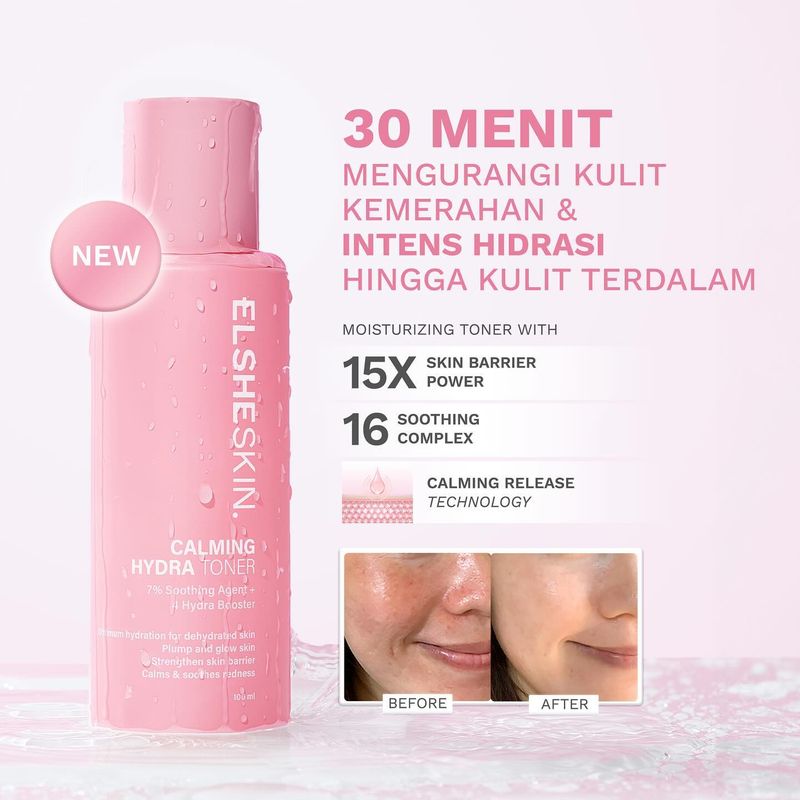 Skincare Untuk Kulit Dehidrasi