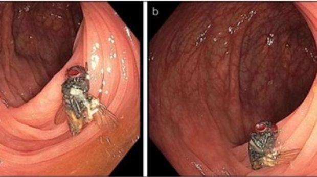Lalat hidup di dalam usus