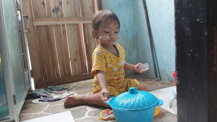 Nafeeza, bocah 3 tahun penderita autoimun, gerd kronis, hingga bocor jantung.