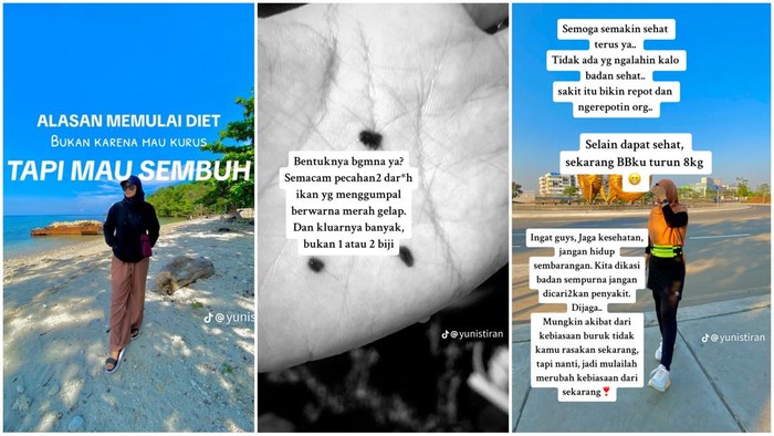Viral Wanita Makassar Harus Diet Bukan Buat Turun BB, Ngaku gegara Tukak Lambung