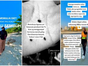 Viral Wanita Makassar Harus Diet Bukan Buat Turun BB, Ngaku gegara Tukak Lambung