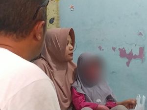 Perjuangan Evi Besarkan Anaknya yang Alami Kelainan Kulit