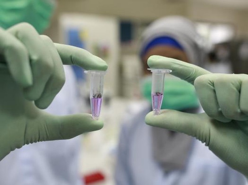 Melihat Bill Gates Digigit Hewan Berbahaya di Yogyakarta