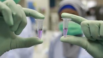 Wadah ini berisi bakteri Wolbachia. Bakteri ini ada pada 70% serangga dunia dan tidak berbahaya untuk manusia. Namun, bakteri ini tidak ada pada nyamuk Aedes aegypti secara alami, sehingga harus ditularkan secara sengaja di laboratorium. Foto: Blog Bill Gates  