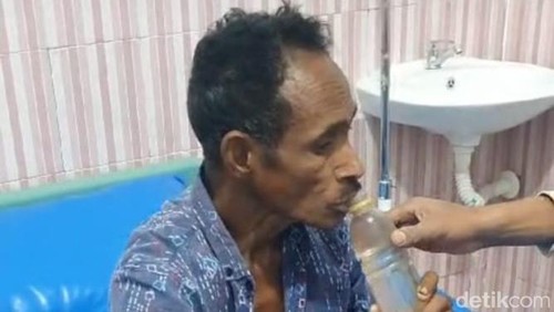 Satu pasien rabies di Soe, Timor Tengah Selatan, NTT meningal dunia.
