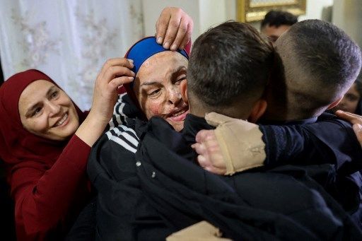 Prominent Palestinian prisoner Israa Jaabis (C) arrives at her home in Israeli-annexed east Jerusalem early on November 26, 2023, after detainees were released from Israeli jails in exchange for hostages released by Hamas from the Gaza Strip. Hamas on November 25, released a second group of Israeli and foreign civilians it had been holding hostage in the Gaza Strip in exchange for Palestinian prisoners, after an hours-long unexpected delay set nerves on edge. Israeli authorities said 13 Israelis and four Thai citizens had returned to Israel. (Photo by Oren ZIV / AFP)