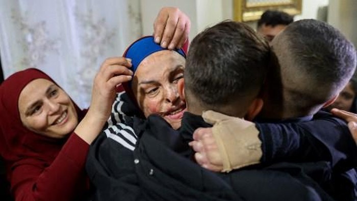 Prominent Palestinian prisoner Israa Jaabis (C) arrives at her home in Israeli-annexed east Jerusalem early on November 26, 2023, after detainees were released from Israeli jails in exchange for hostages released by Hamas from the Gaza Strip. Hamas on November 25, released a second group of Israeli and foreign civilians it had been holding hostage in the Gaza Strip in exchange for Palestinian prisoners, after an hours-long unexpected delay set nerves on edge. Israeli authorities said 13 Israelis and four Thai citizens had returned to Israel. (Photo by Oren ZIV / AFP)