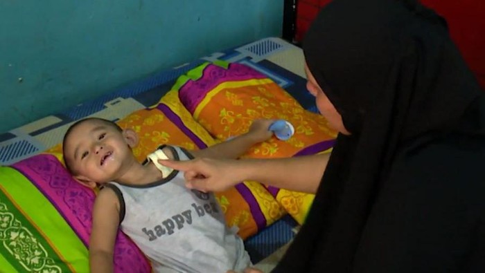 Amar, bocah yang didiagnosis mengalami gerd, stenosis duodenum atau kelainan pada usus dua belas jari, jantung bocor, dan kelainan pada testisnya.