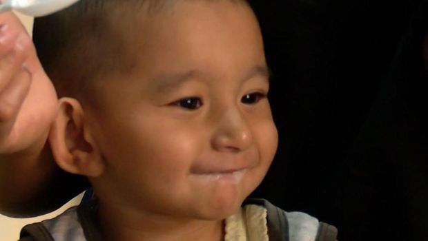 Amar, bocah yang didiagnosis mengalami gerd, stenosis duodenum atau kelainan pada usus dua belas jari, jantung bocor, dan kelainan pada testisnya.