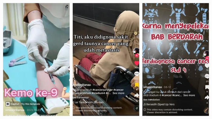 Viral Wanita Pekanbaru Alami Gejala Mirip GERD saat Hamil, Rupanya Kanker Rektum