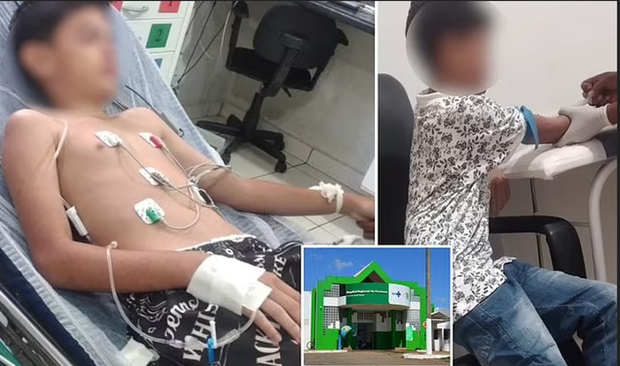 Duh! Bocah Ini Dilarikan ke Rumah Sakit Usai Makan Tokek Goreng