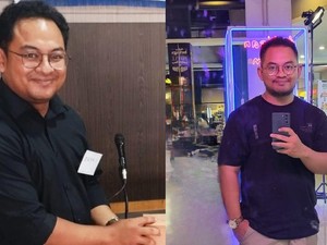 Pria Tasikmalaya Umur 28 Kena Diabetes, Diduga gegara Doyan Banget Minuman Manis