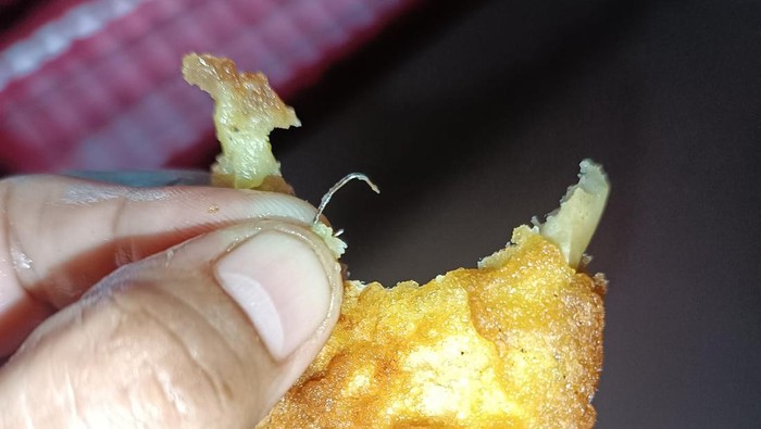 Ada Staples di Dalam Gorengan, Lidah Anak Ini Terluka