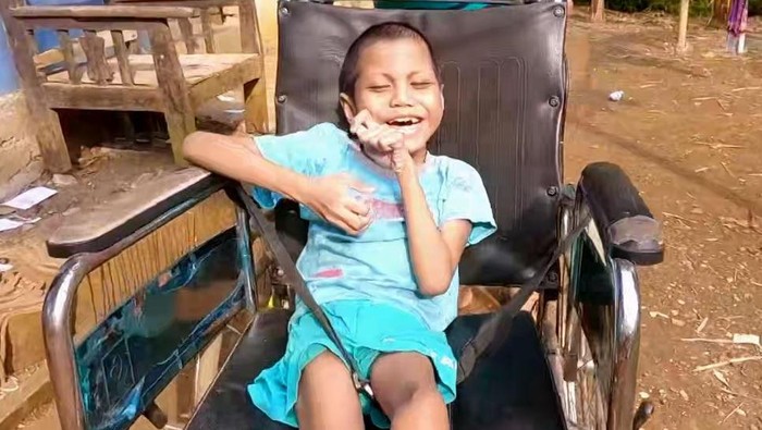 Ibnu (10)  yang menderita radang otak