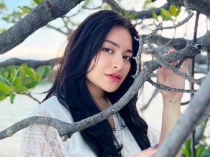 Nathalie Holscher Ungkap Alasan Jalani Operasi Bariatrik