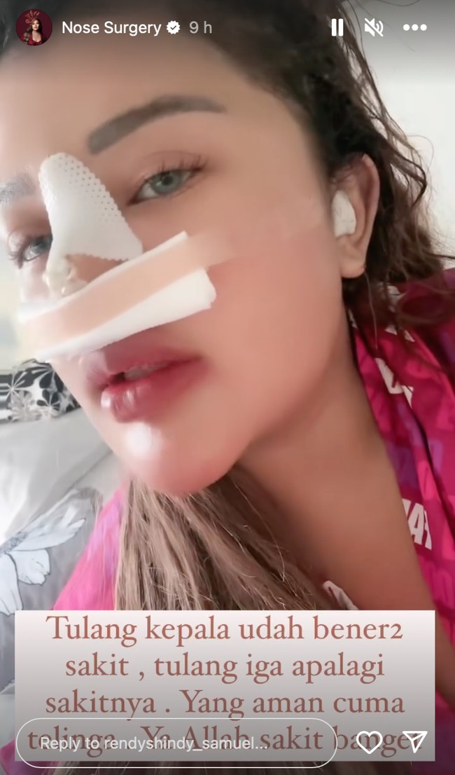 Dengan hidung yang masih dipenuhi perban Shindy membagikan keadaan dirinya setelah menjalani operasi hidung. Di akun Instagramnya ia juga sampai membuat highlights khusus mengenai operasi hidung yang baru dijalaninya. Foto: Instagram/@rendyshindy_samuel