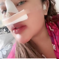 Dengan hidung yang masih dipenuhi perban Shindy membagikan keadaan dirinya setelah menjalani operasi hidung. Di akun Instagramnya ia juga sampai membuat highlights khusus mengenai operasi hidung yang baru dijalaninya. Foto: Instagram/@rendyshindy_samuel