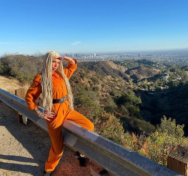 Dia mengalami infeksi setelah cedera dan tertular sepsis. Foto: dok. Instagram